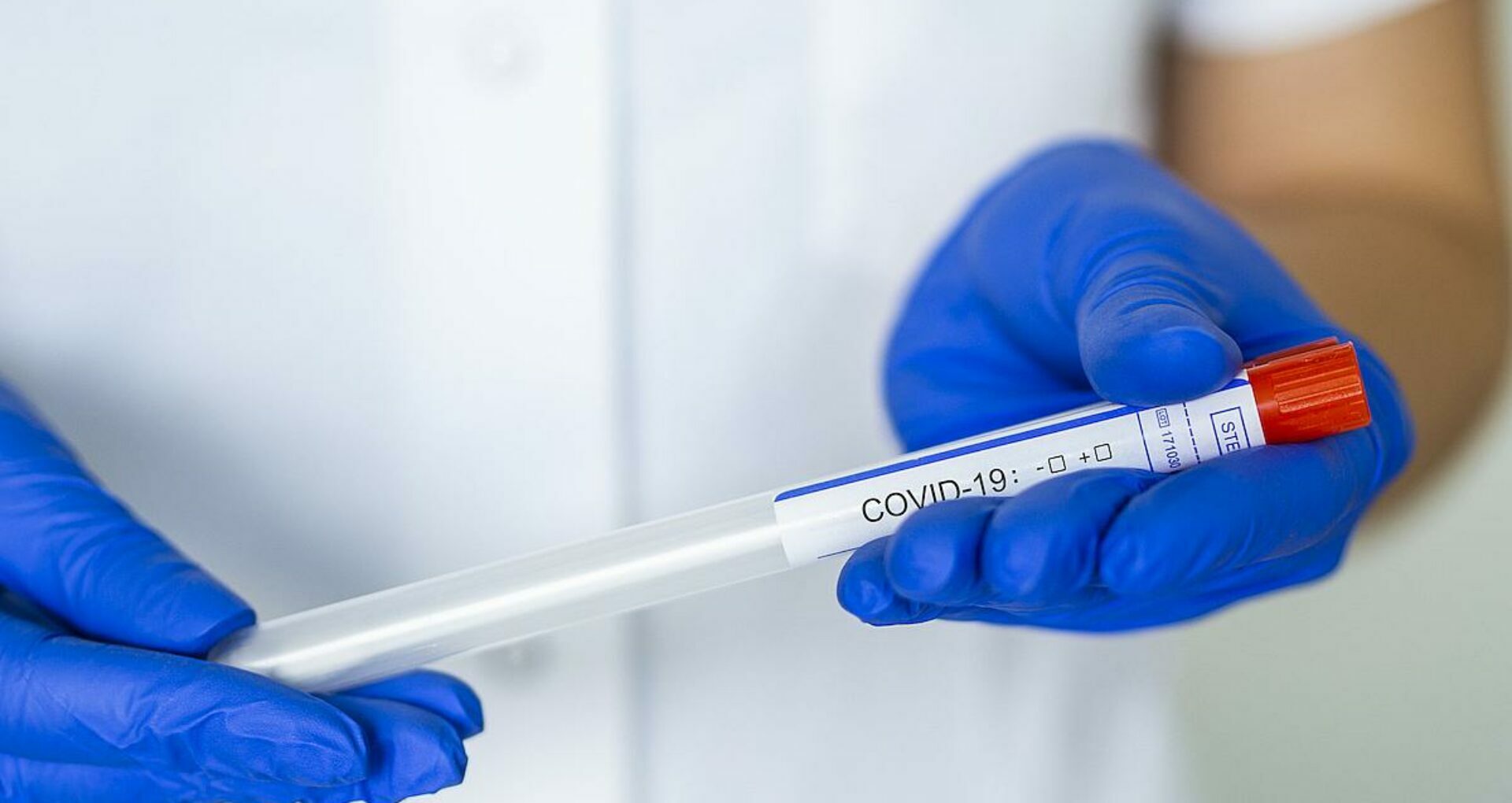 Moldova Reports 380 New Cases of Coronavirus