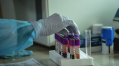 Moldova Reports 560 New Cases of Coronavirus