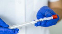 Moldova Reports 380 New Cases of Coronavirus