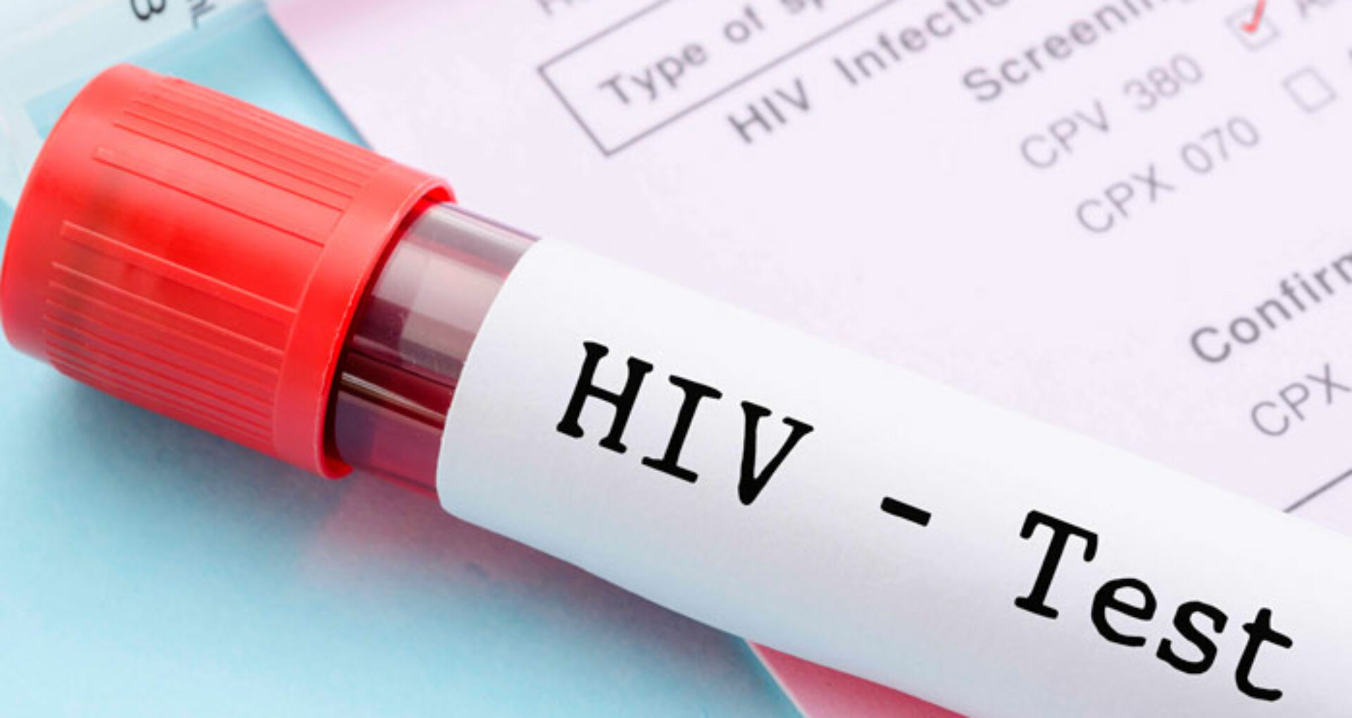 Ziua Mondială de Combatere HIV/ SIDA. Ce arată datele statistice în R. Moldova dar și în lume