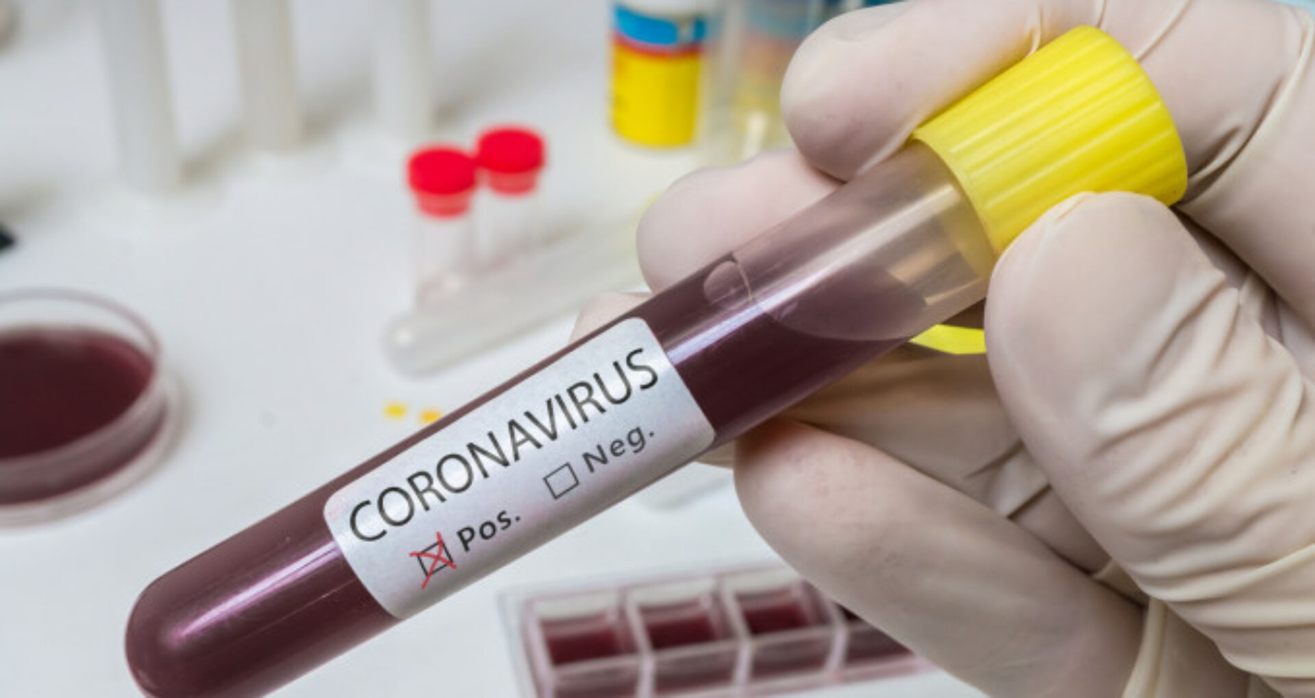 A treia moldoveancă stabilită în Italia a fost diagnosticată cu noul coronavirus