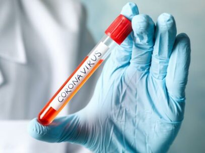 DOC/ Cod roșu la nivel naţional referitor la situaţia epidemiologică prin infecţia cu coronavirus