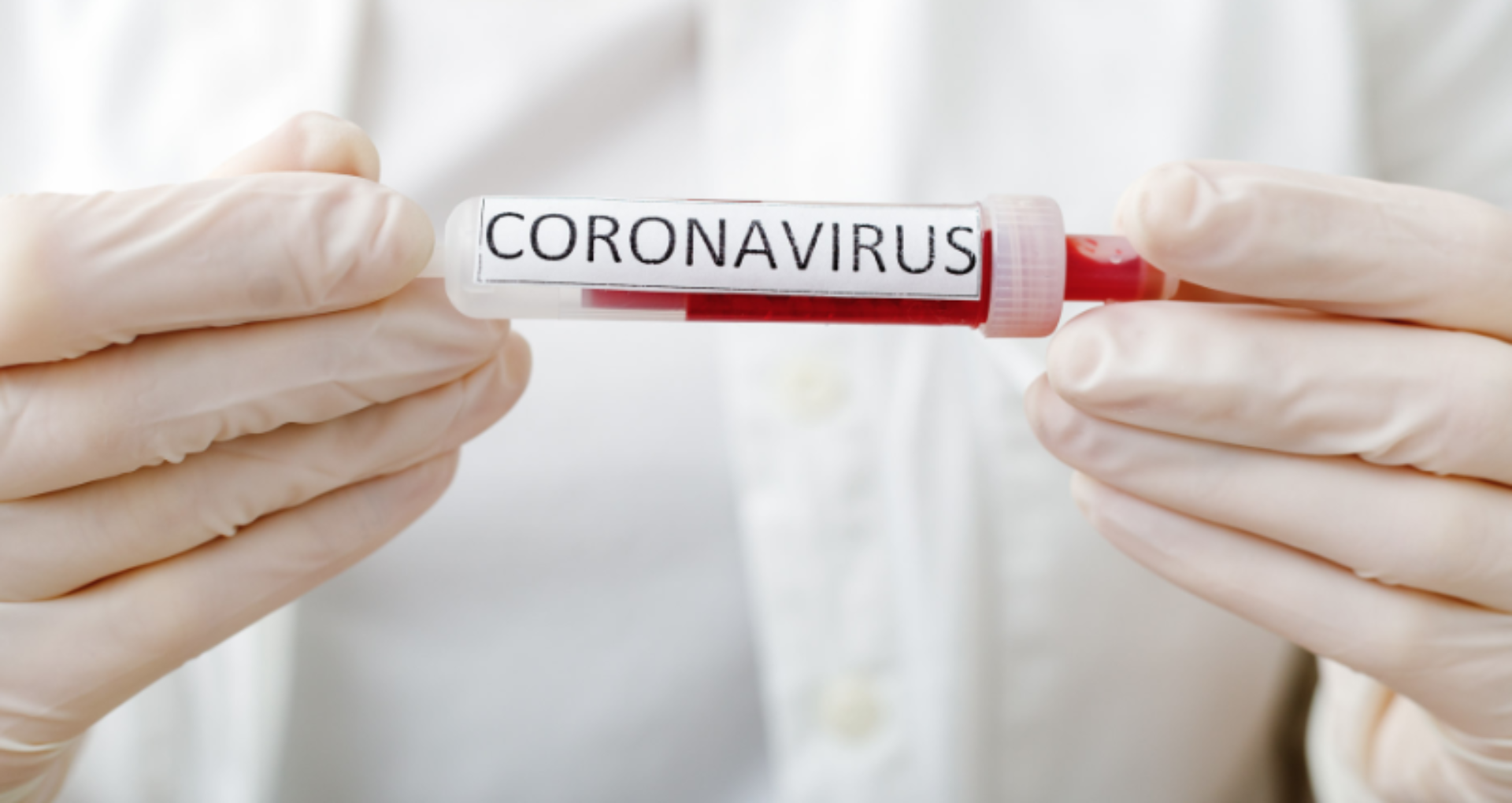 Poţi omorî virusul cu usturoi, antibiotice sau dacă îţi faci baie cu alcool? OMS demontează miturile despre coronavirus. Informațiile false care circulă online