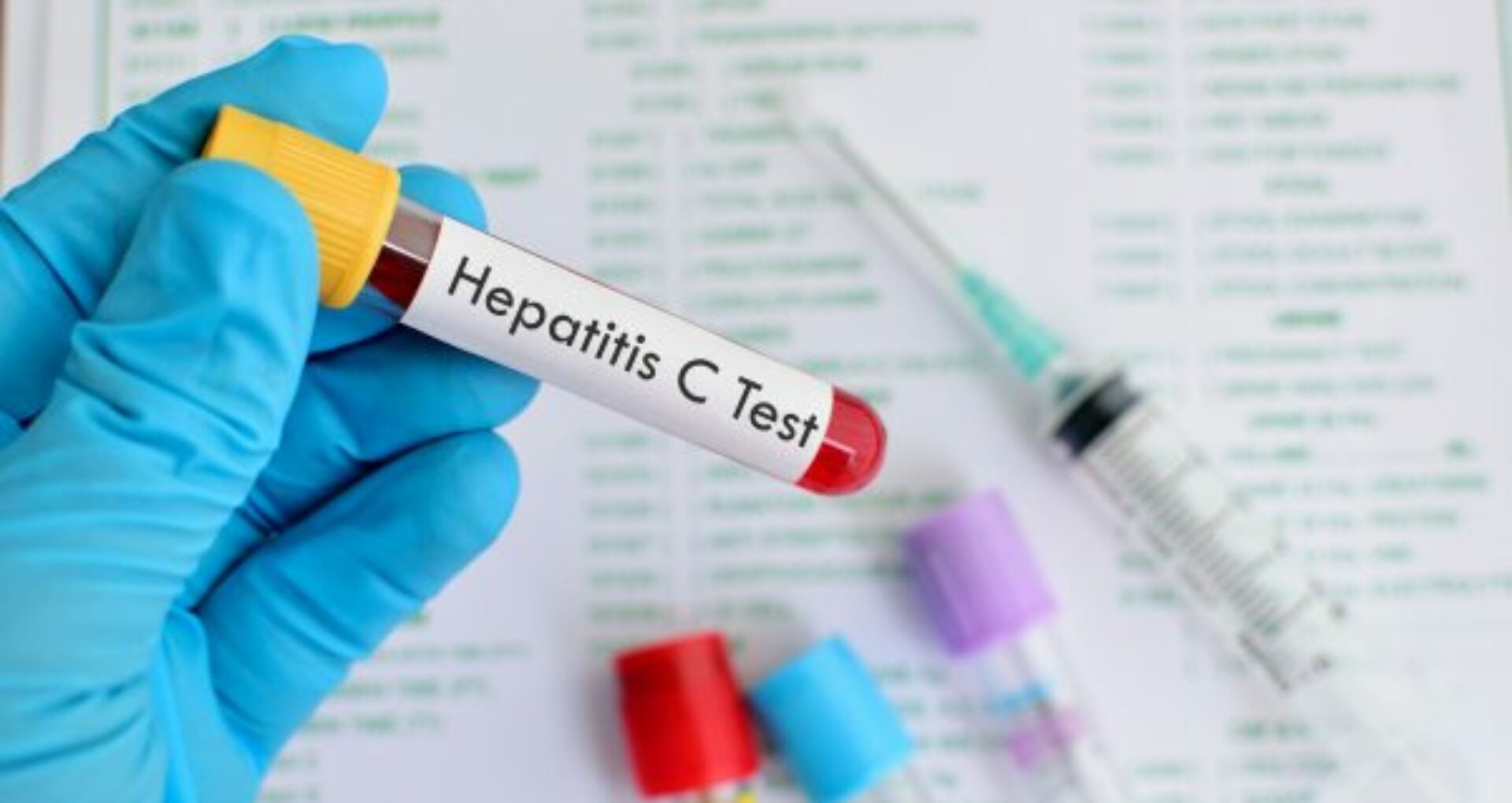 În R. Moldova a fost lansată testarea de screening la hepatitele virale B și C cu Teste Rapide de Diagnostic