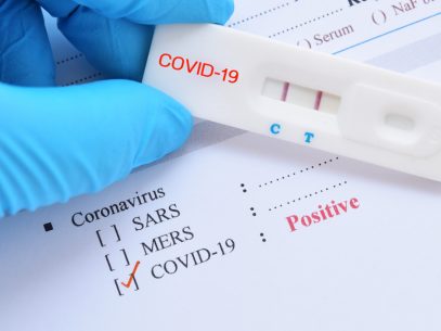 Alte 39 de cazuri noi de infectare cu COVID-19 dintre care unul de import și un deces înregistrate în ultimele 24 de ore în R. Moldova