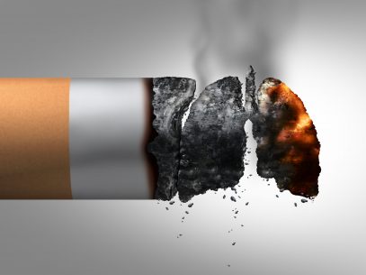 „70% dintre pacienții cu cancer pulmonar sunt fumători înrăiți”. Ziua mondială fără tutun: care sunt riscurile fumatului